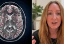 A split image showing a medical brain MRI scan with larvae lesions on the left and a portrait of a 42-year-old British woman, Lawrie Denman, on the right.